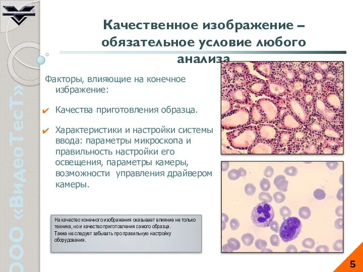 ООО «ВидеоТесТ» 5 Качественное изображение – обязательное условие любого анализа Факторы,