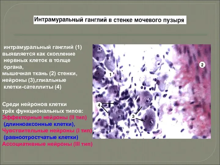 интрамуральный ганглий (1) выявляется как скопление нервных клеток в толще органа,