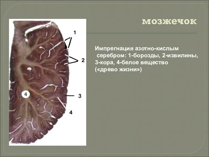 мозжечок Импрегнация азотно-кислым серебром: 1-борозды, 2-извилины, 3-кора, 4-белое вещество («древо жизни»)