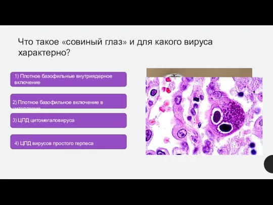 Что такое «совиный глаз» и для какого вируса характерно? 1) Плотное