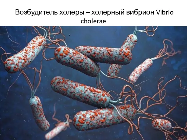 Возбудитель холеры – холерный вибрион Vibrio cholerae