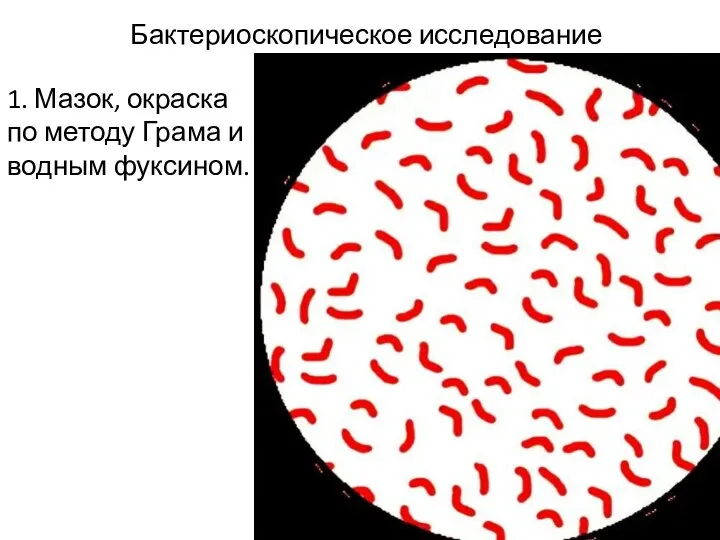 Бактериоскопическое исследование 1. Мазок, окраска по методу Грама и водным фуксином.