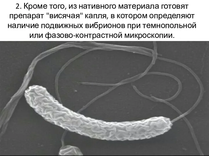 2. Кроме того, из нативного материала готовят препарат "висячая" капля, в