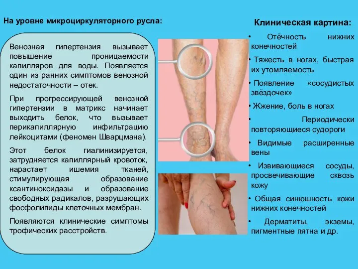 На уровне микроциркуляторного русла: Венозная гипертензия вызывает повышение проницаемости капилляров для