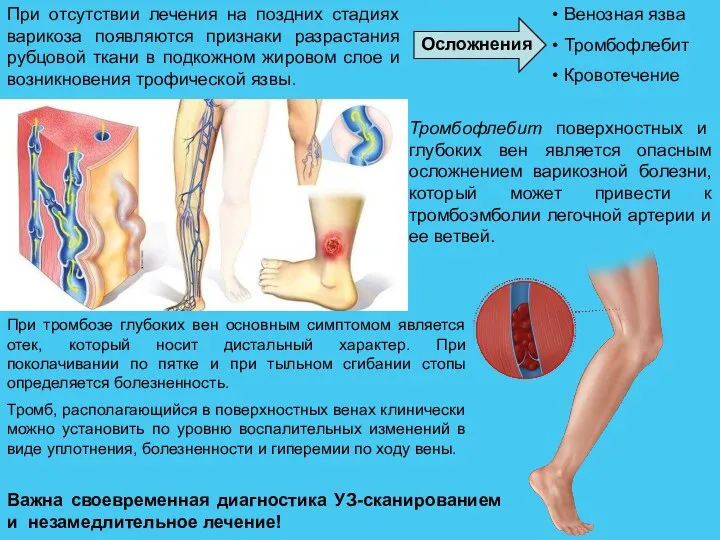 При отсутствии лечения на поздних стадиях варикоза появляются признаки разрастания рубцовой