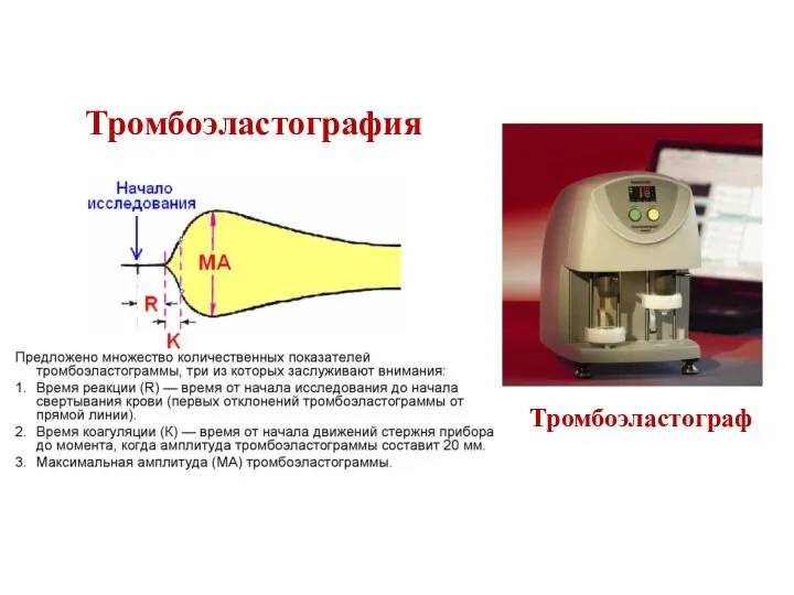 Тромбоэластография Тромбоэластограф