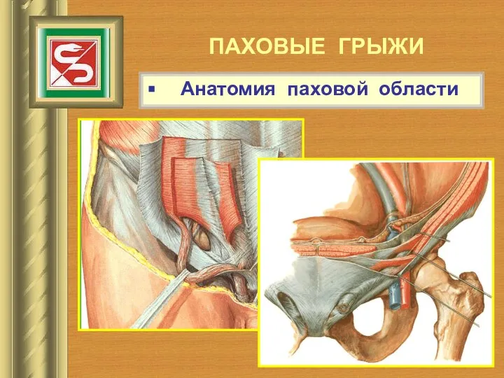 ПАХОВЫЕ ГРЫЖИ Анатомия паховой области