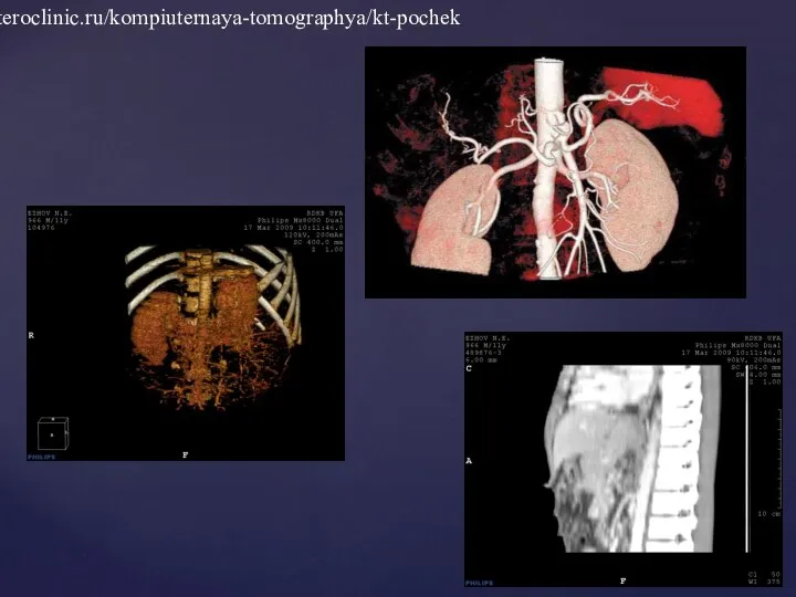 http://pateroclinic.ru/kompiuternaya-tomographya/kt-pochek