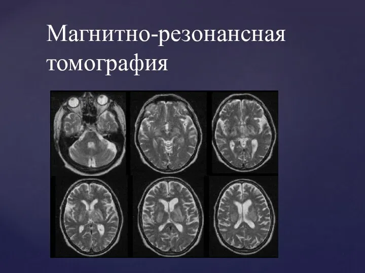 Магнитно-резонансная томография