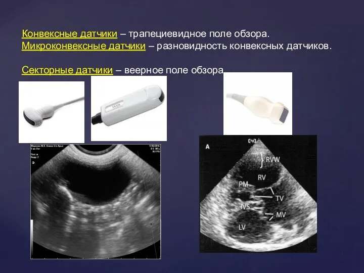 Конвексные датчики – трапециевидное поле обзора. Микроконвексные датчики – разновидность конвексных