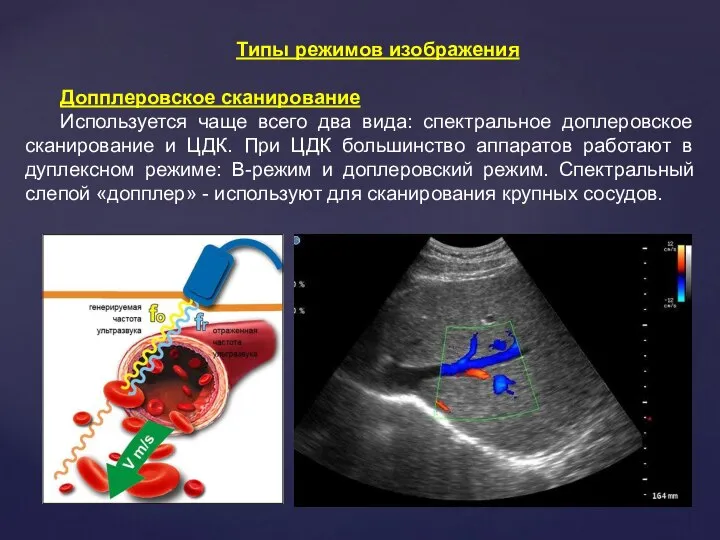 Типы режимов изображения Допплеровское сканирование Используется чаще всего два вида: спектральное