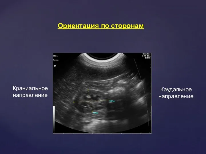 Ориентация по сторонам Краниальное направление Каудальное направление