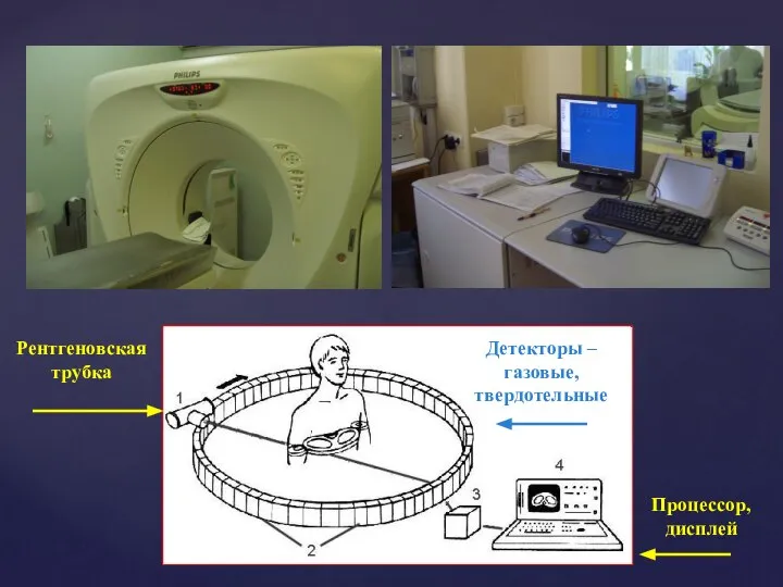 Рентгеновская трубка Детекторы – газовые, твердотельные Процессор, дисплей