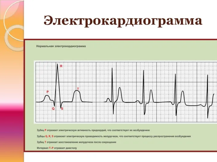 Электрокардиограмма