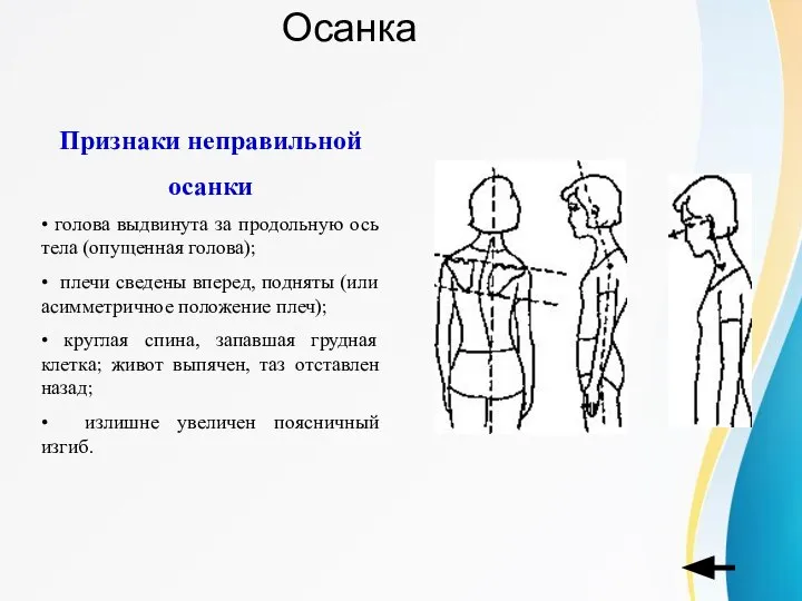 Осанка Признаки неправильной осанки • голова выдвинута за продольную ось тела