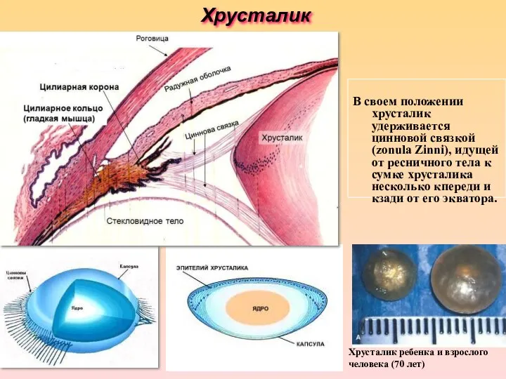 Хрусталик В своем положении хрусталик удерживается цинновой связкой (zonula Zinni), идущей