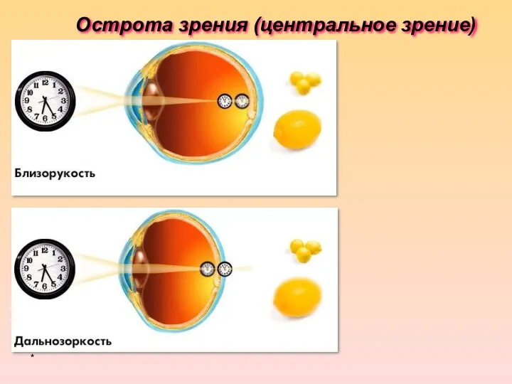 * Острота зрения (центральное зрение)