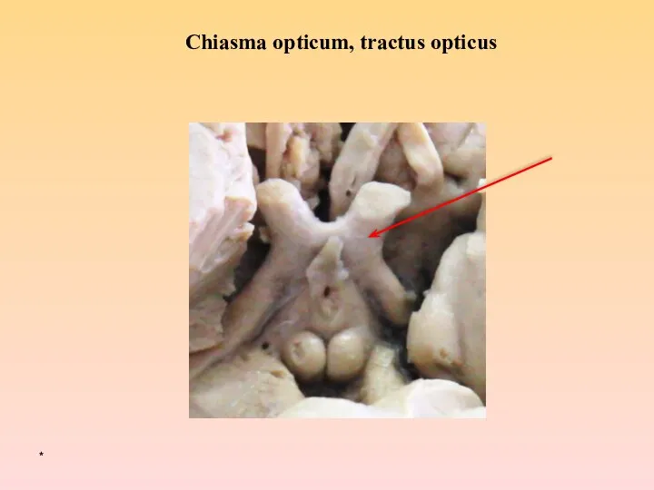 * Chiasma opticum, tractus opticus