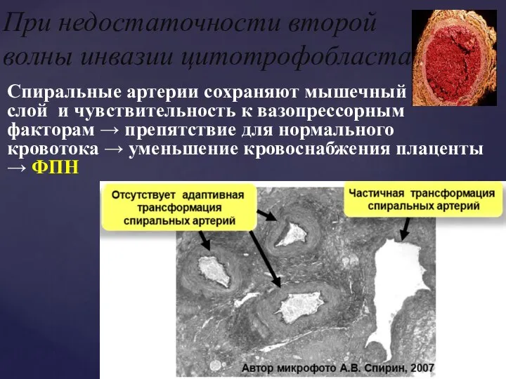 Спиральные артерии сохраняют мышечный слой и чувствительность к вазопрессорным факторам →