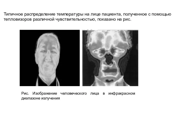 Типичное распределение температуры на лице пациента, полученное с помощью тепловизоров различной