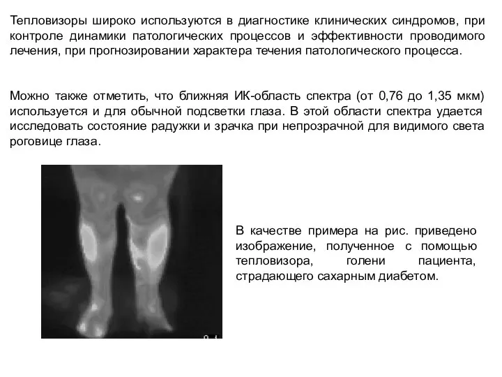 Тепловизоры широко используются в диагностике клинических синдромов, при контроле динамики патологических