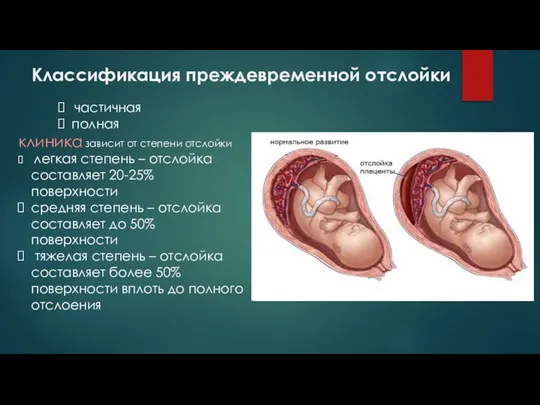 частичная полная клиника зависит от степени отслойки легкая степень – отслойка