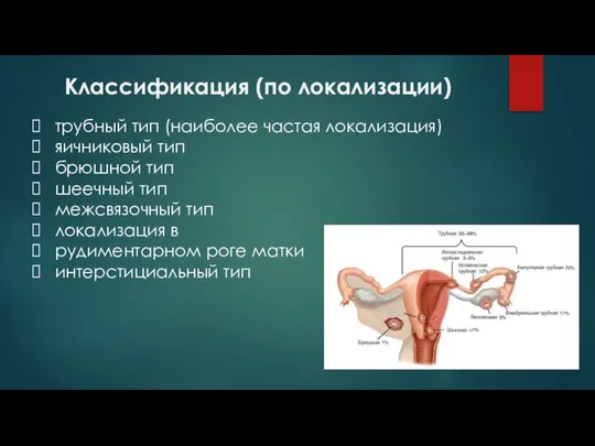 Классификация (по локализации) трубный тип (наиболее частая локализация) яичниковый тип брюшной