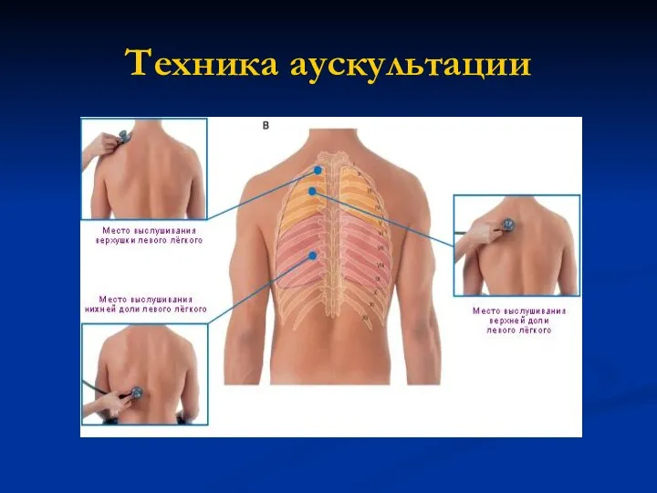 Техника аускультации