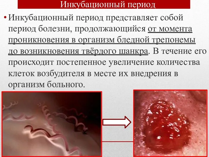 Инкубационный период Инкубационный период представляет собой период болезни, продолжающийся от момента