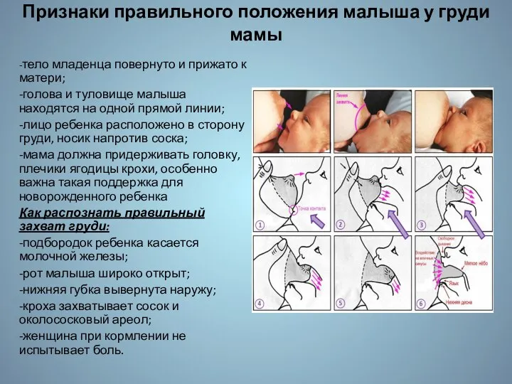 Признаки правильного положения малыша у груди мамы -тело младенца повернуто и