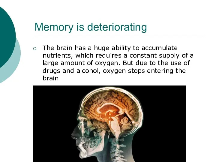 Memory is deteriorating The brain has a huge ability to accumulate