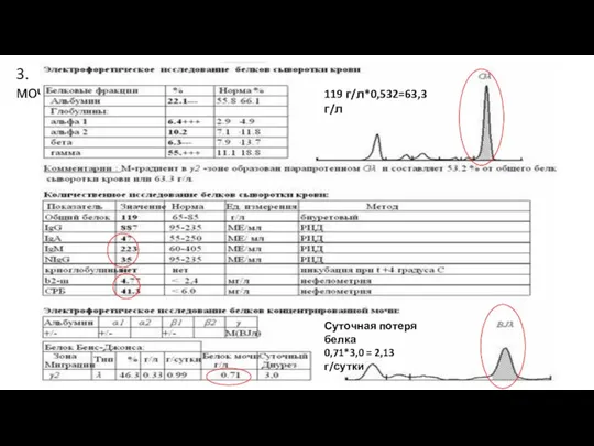 3. Иммунохимическое исследование белков сыворотки крови и мочи 119 г/л*0,532=63,3 г/л