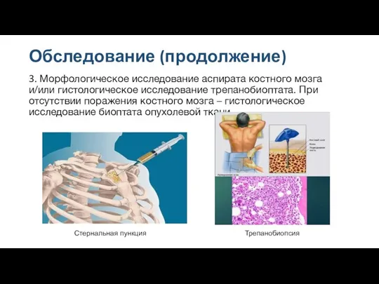 Обследование (продолжение) 3. Морфологическое исследование аспирата костного мозга и/или гистологическое исследование