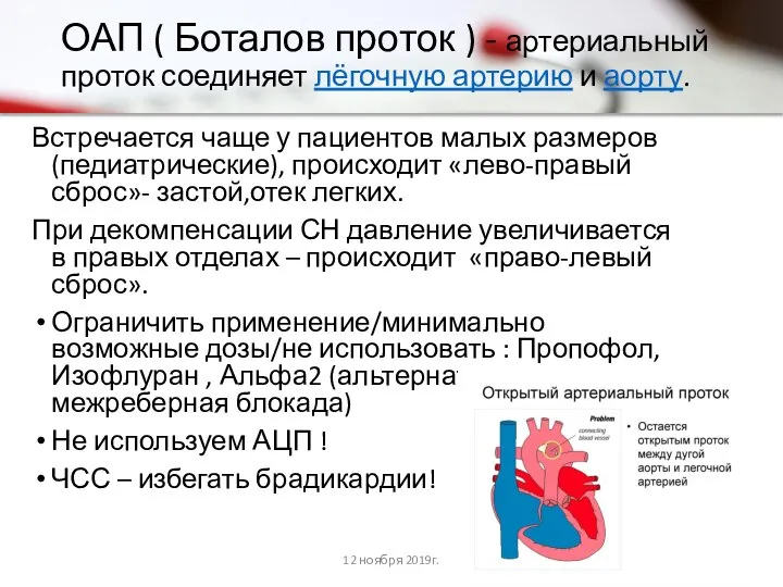 ОАП ( Боталов проток ) - артериальный проток соединяет лёгочную артерию