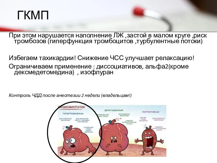 ГКМП При этом нарушается наполнение ЛЖ ,застой в малом круге ,риск