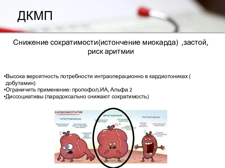 ДКМП 12 ноября 2019г. Снижение сократимости(истончение миокарда) ,застой, риск аритмии Высока