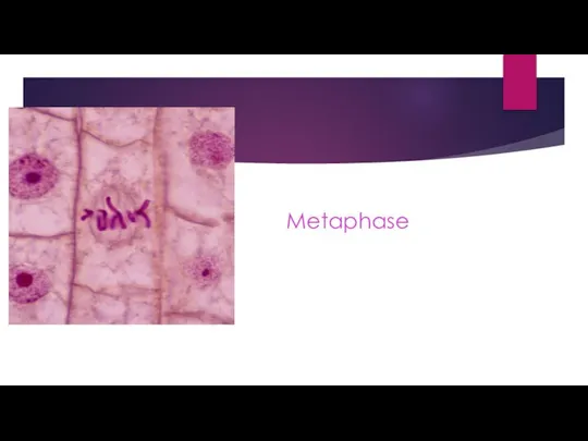 Metaphase