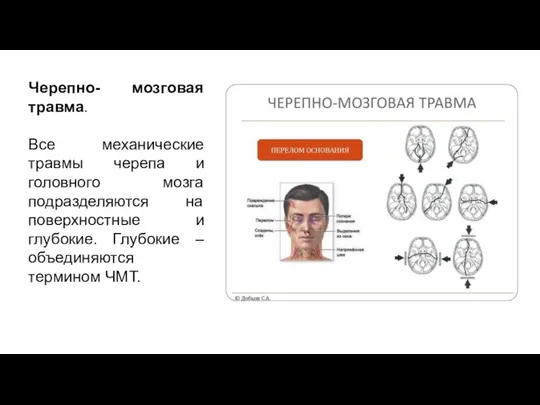 Черепно- мозговая травма. Все механические травмы черепа и головного мозга подразделяются