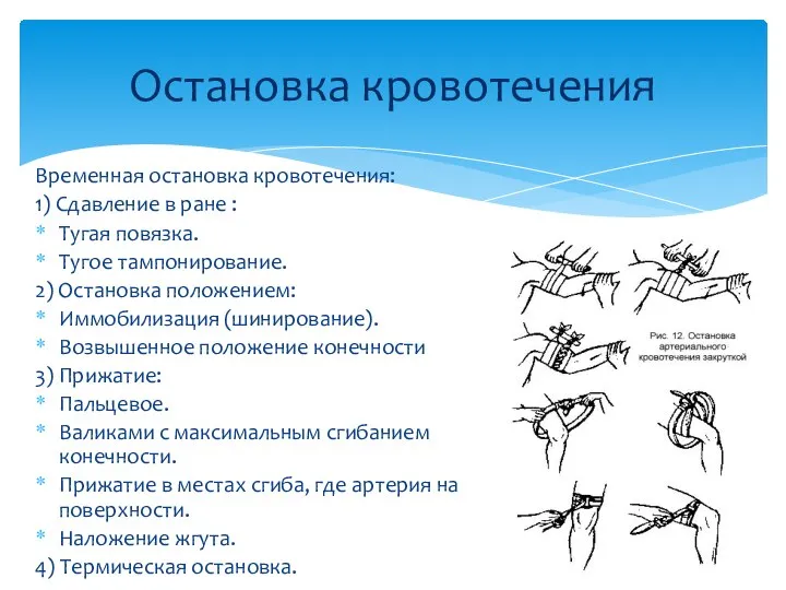 Временная остановка кровотечения: 1) Сдавление в ране : Тугая повязка. Тугое