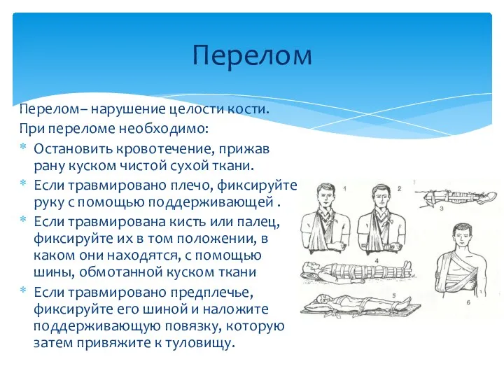 Перелом– нарушение целости кости. При переломе необходимо: Остановить кровотечение, прижав рану