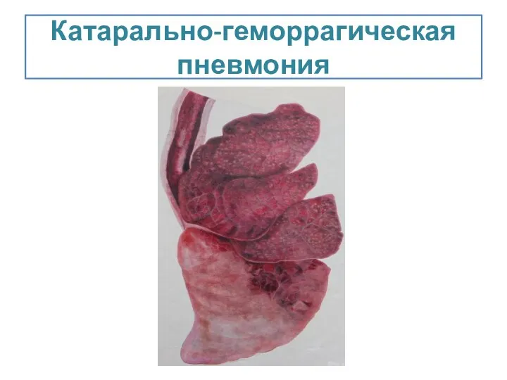 Катарально-геморрагическая пневмония