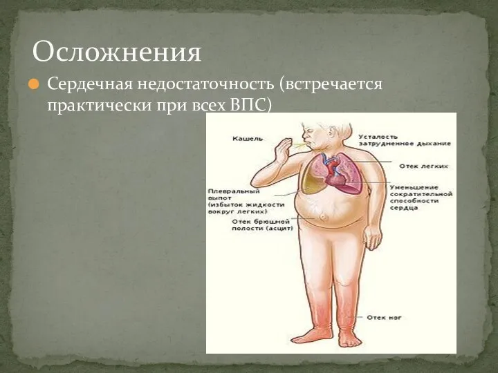 Сердечная недостаточность (встречается практически при всех ВПС) Осложнения