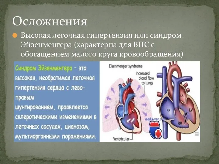 Высокая легочная гипертензия или синдром Эйзенменгера (характерна для ВПС с обогащением малого круга кровообращения) Осложнения