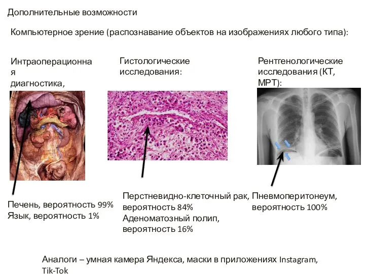 Дополнительные возможности Компьютерное зрение (распознавание объектов на изображениях любого типа): Интраоперационная