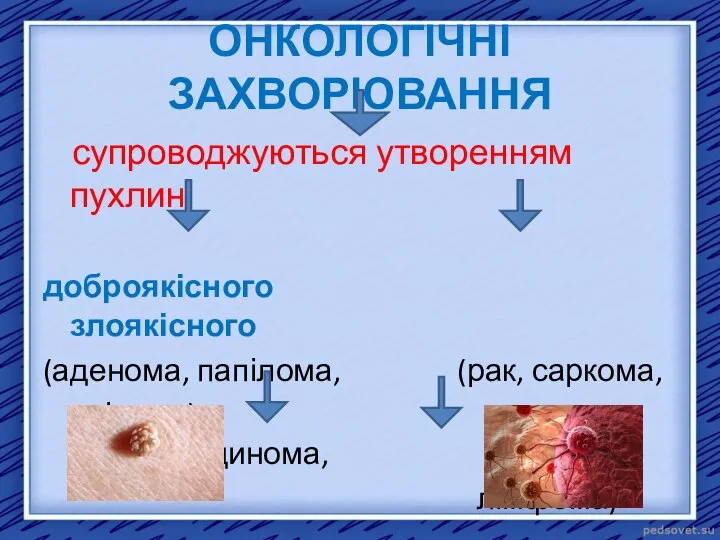 ОНКОЛОГІЧНІ ЗАХВОРЮВАННЯ супроводжуються утворенням пухлин доброякісного злоякісного (аденома, папілома, (рак, саркома, ліпома) аденокарцинома, лімфома) характеру