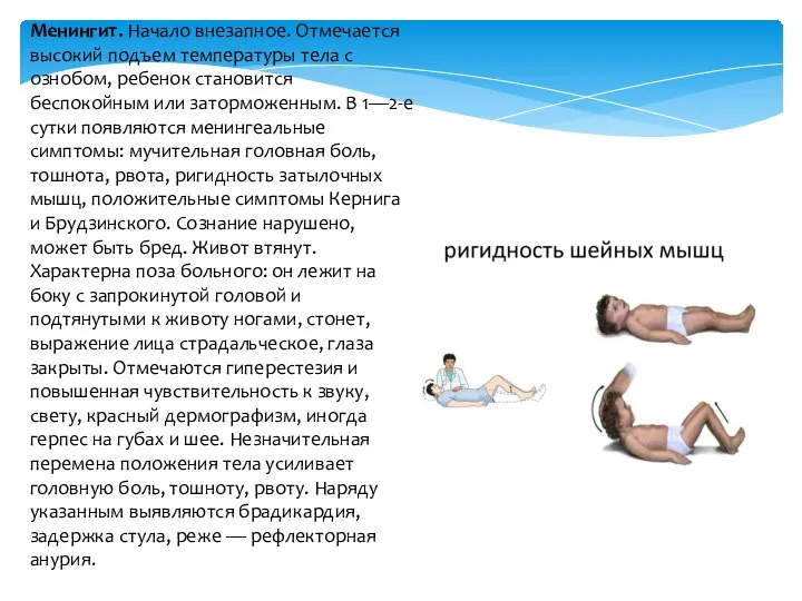 Менингит. Начало внезапное. Отмечается высокий подъем температуры тела с ознобом, ребенок