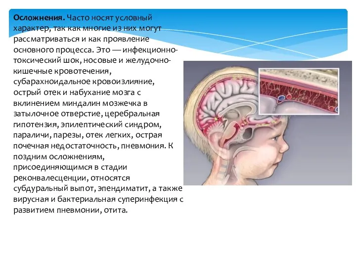 Осложнения. Часто носят условный характер, так как многие из них могут