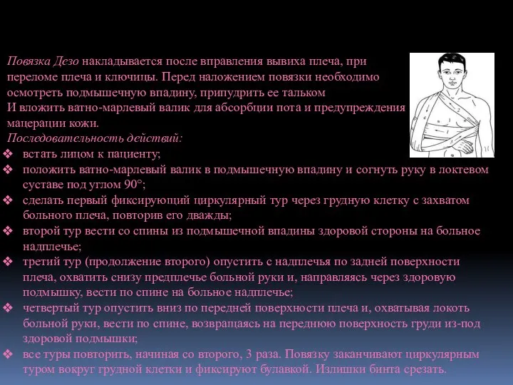 Повязка Дезо накладывается после вправления вывиха плеча, при переломе плеча и