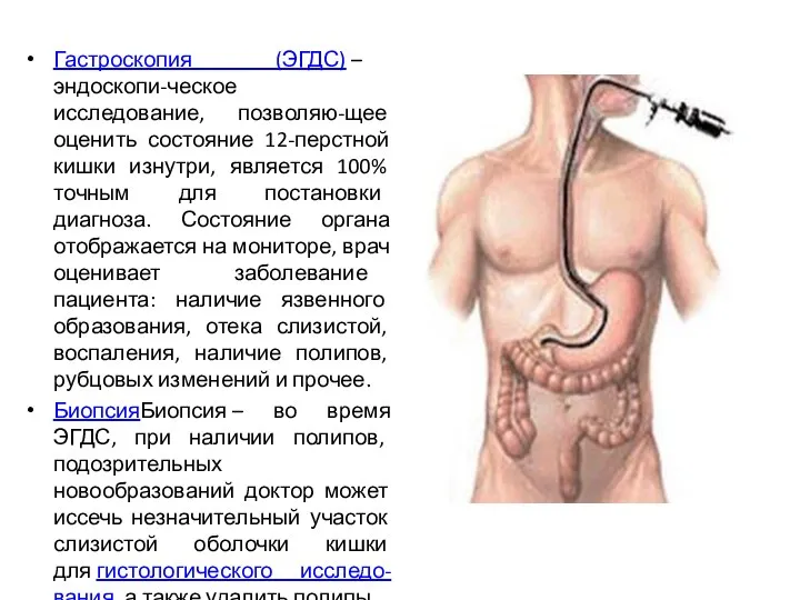 Гастроскопия (ЭГДС) – эндоскопи-ческое исследование, позволяю-щее оценить состояние 12-перстной кишки изнутри,