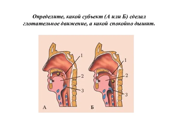 Определите, какой субъект (А или Б) сделал глотательное движение, а какой спокойно дышит.